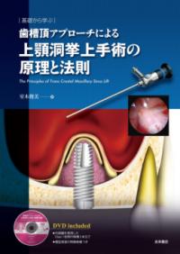 歯槽頂アプローチによる上顎洞挙上手術の原理と法則 : 基礎から学ぶ ...