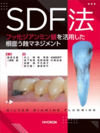歯の自家移植を始めよう! : インプラント時代に見直す歯根膜の活用
